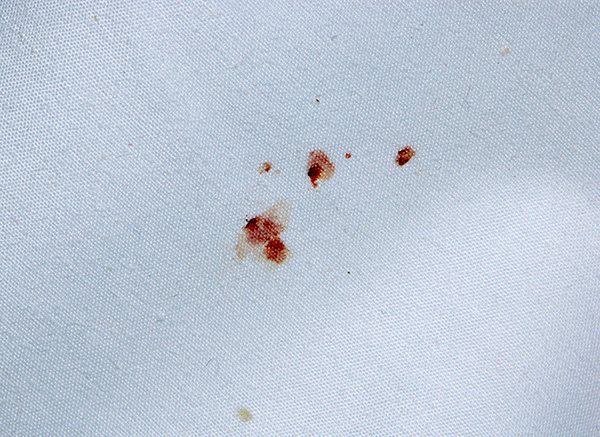 А вот еще один пример пятен крови на постели, зараженной клопами.