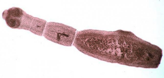 Эхинококк от кошки к человеку - фото под микроскопом