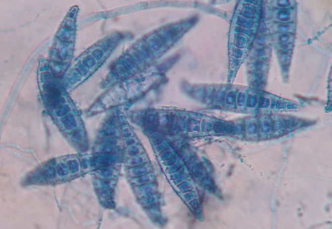 Грибок Microsporum