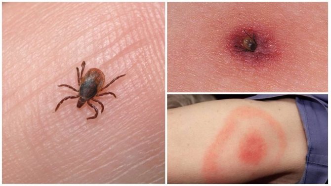 Как выглядят укусы насекомых, фото - кто укусил, последствия