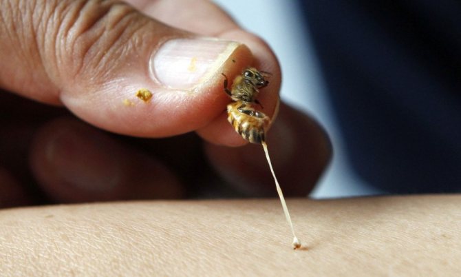 Почему пчела умирает после укуса