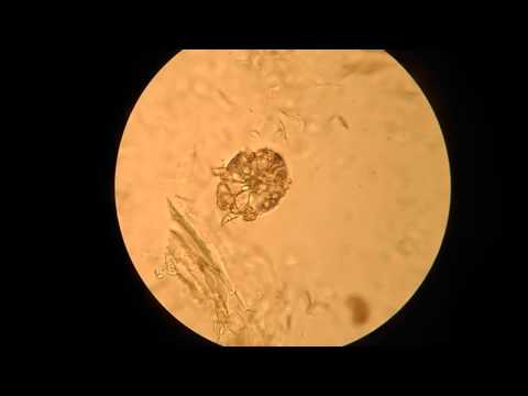 Саркоптоз у собаки (Sarcoptes scabiei, микроскопия)