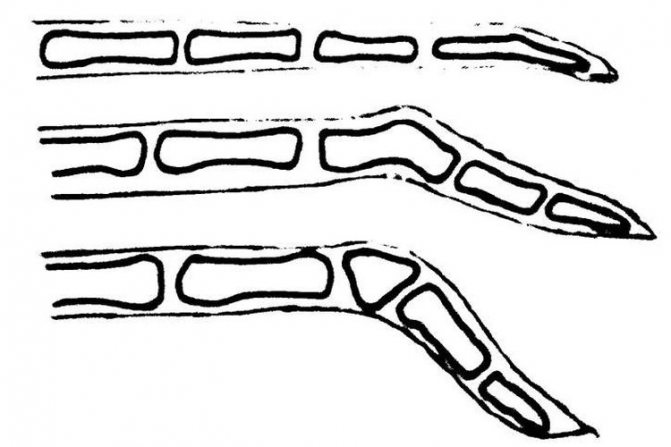 Схематическое изображение переломов хвоста