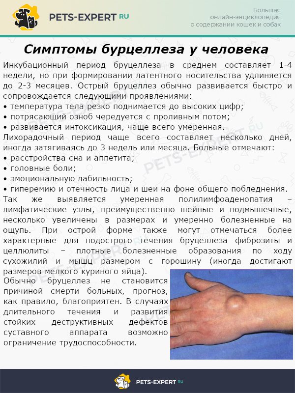 Симптомы бурцеллеза у человека
