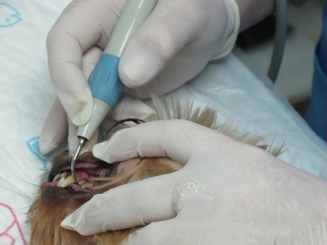 Удаление зубного налёта в клинике