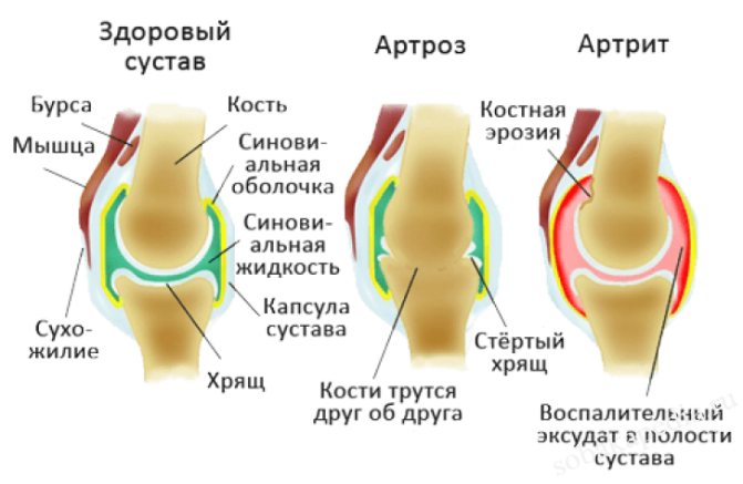 Виды артрита у собак